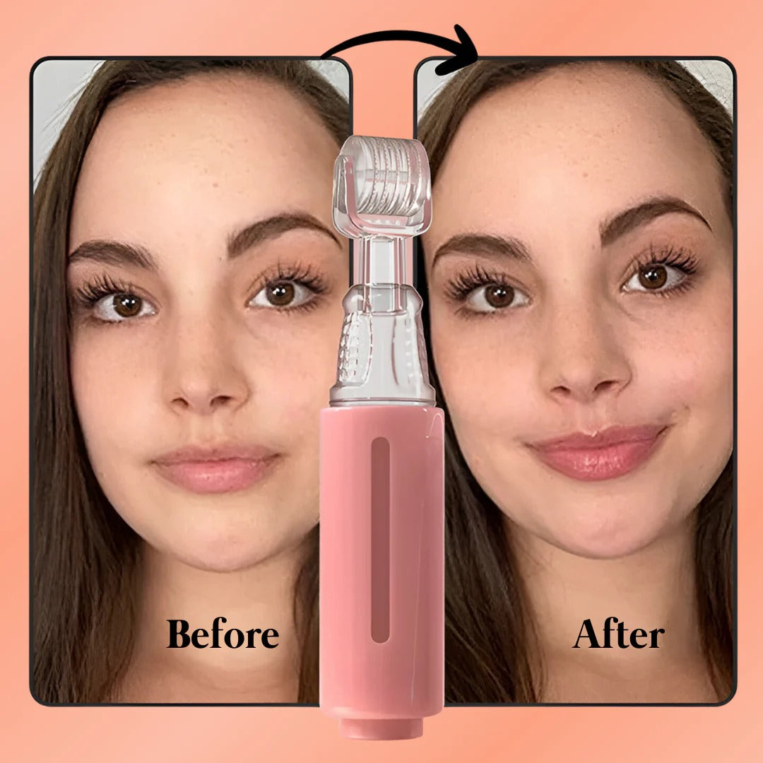 Naturally Fuller Lips Kit With Gentle Formula And Easy Use