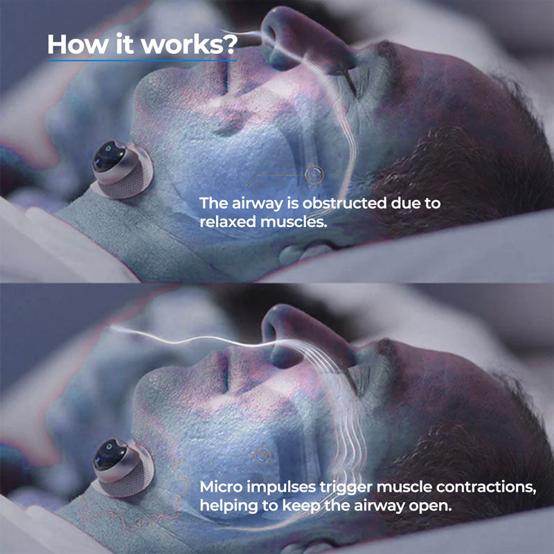 Smart Wearable Chin Clip With Snore Detection For Quieter Nights