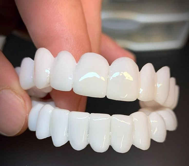 SmileLift Replacement Teeth With Customizable Lenses For A Natural Look