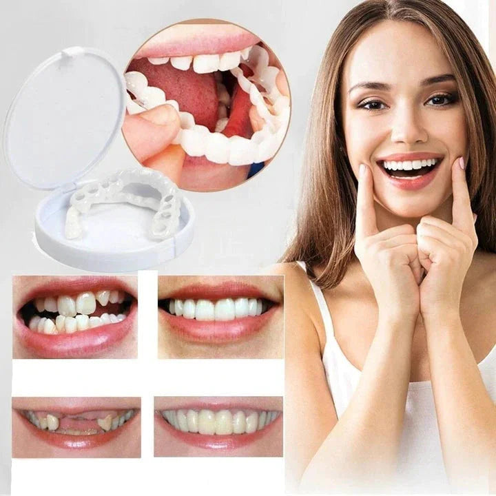 NovaBright Snap-On Veneers For Top And Bottom Teeth Custom Fit Removable Smile Solution