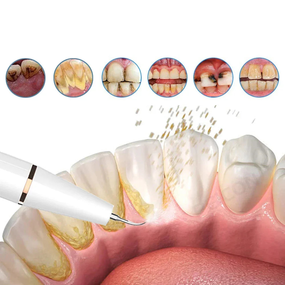 Rechargeable Ultrasonic Teeth Cleaner With Ergonomic Handle For Home Oral Care